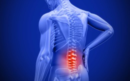 Đau lưng: những điều cần biết