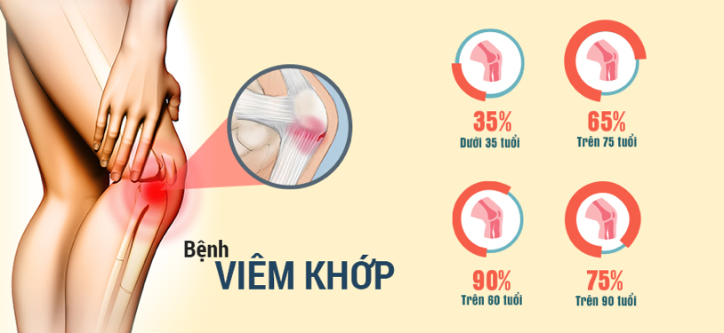 7 điều cần biết về bệnh lý cơ xương khớp